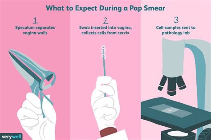 Pap Smear Test Purpose, Procedure, Results